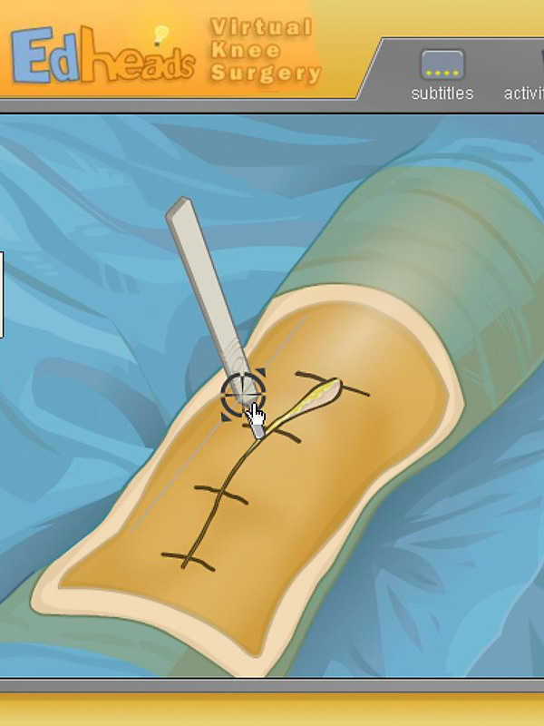 Virtual Knee Surgery